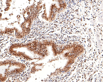 BRD2 antibody