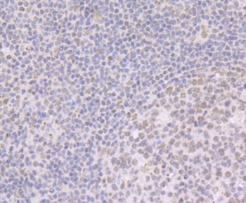 BRD2 antibody