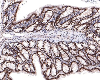 BRD2 antibody