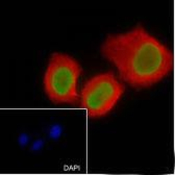 Histone H4 (acetyl K16) antibody