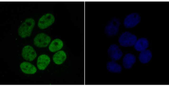 Histone H4 (acetyl K16) antibody