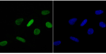 Histone H4 (acetyl K16) antibody