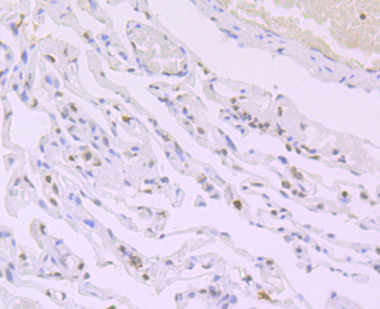 Histone H4 (acetyl K16) antibody