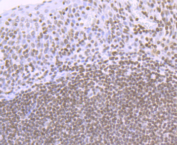 Histone H4 (acetyl K16) antibody