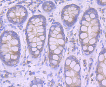 Furin antibody