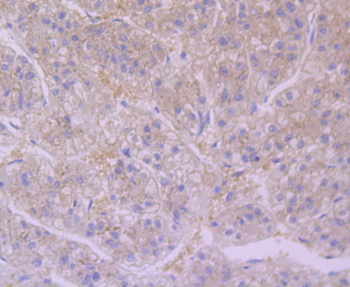 Furin antibody