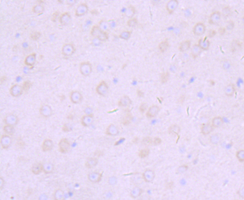 Furin antibody