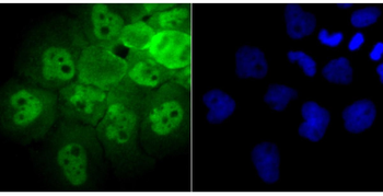 PSMB8 antibody