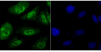 PSMB8 antibody