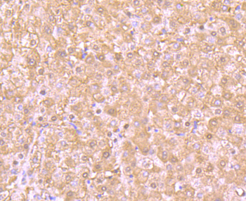 PSMB8 antibody