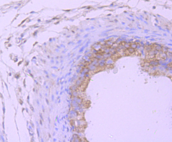 PSMB8 antibody