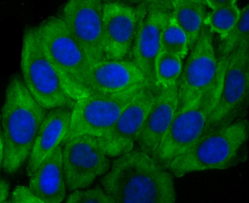 Growth hormone receptor antibody