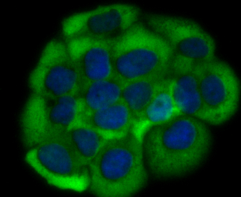 Growth hormone receptor antibody