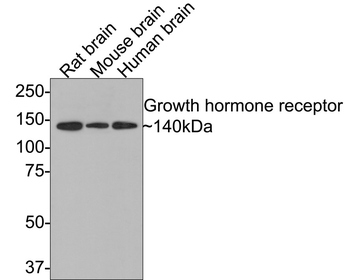 Growth hormone receptor antibody