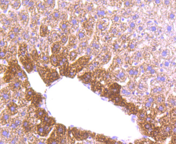 MMP3 antibody