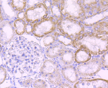 MMP3 antibody