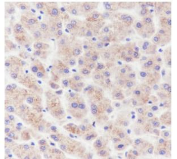 MMP3 antibody