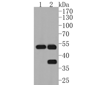 MMP3 antibody