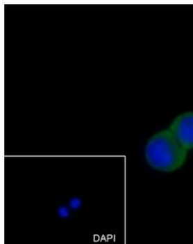 MMP3 antibody