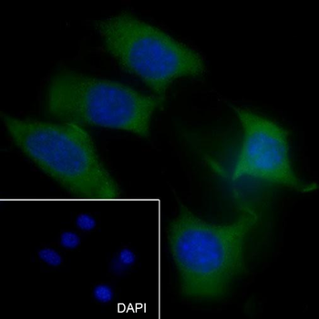 MMP3 antibody