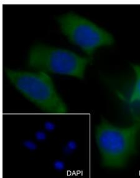 MMP3 antibody