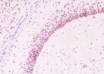 BMAL1 antibody