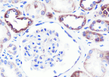 GBA antibody