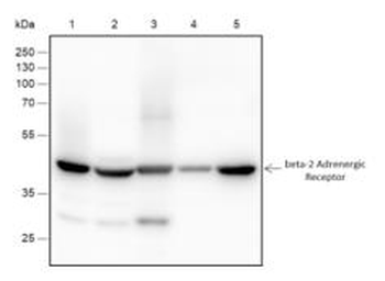 ADRB2 antibody