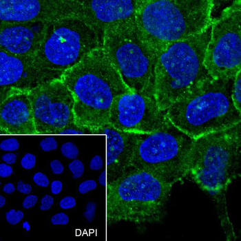 ADRB2 antibody