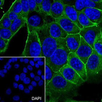 ADRB2 antibody