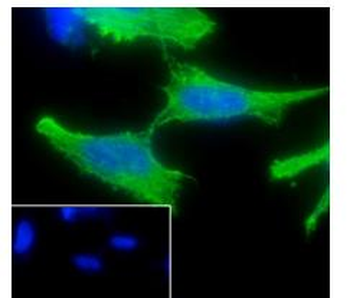 ADRB2 antibody