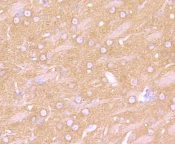 ADRB2 antibody