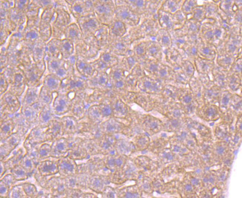 ADRB2 antibody