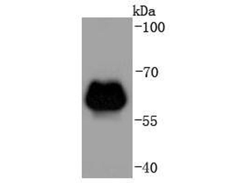 ADRB2 antibody