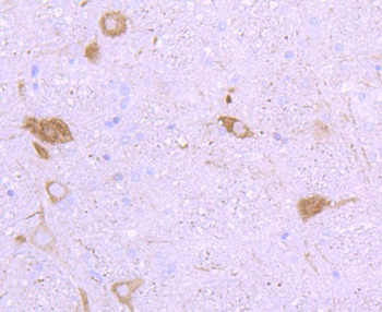 NF-H antibody