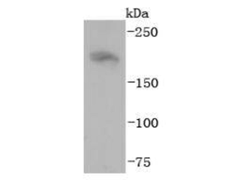 NF-H antibody