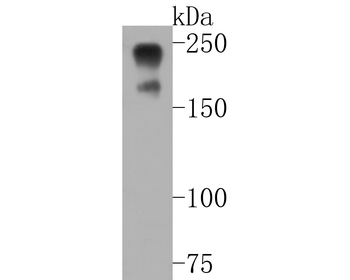 NF-H antibody