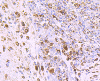 IGF2 antibody