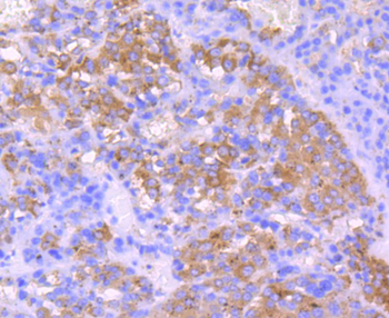 IGF2 antibody