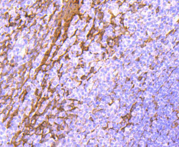 Hsp27 antibody