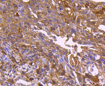 Hsp27 antibody