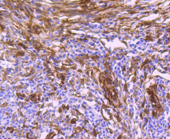 Hsp27 antibody