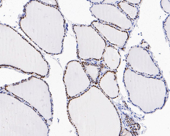 PAX8 antibody