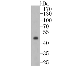 PAX8 antibody