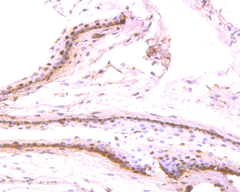 PAX6 antibody