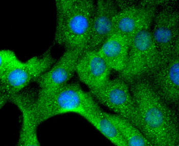 Tyrosine Hydroxylase antibody