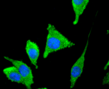 Tyrosine Hydroxylase antibody