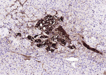 Tyrosine Hydroxylase antibody