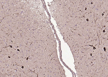 Tyrosine Hydroxylase antibody