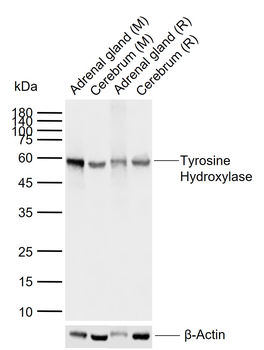 Tyrosine Hydroxylase antibody